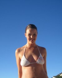 Девка уснула на пляже и ее кожа стала красной 8 фотография Девка уснула на пляже и ее кожа стала красной 8 фотография