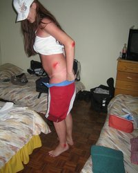 Девка уснула на пляже и ее кожа стала красной 23 фотография Девка уснула на пляже и ее кожа стала красной 23 фотография