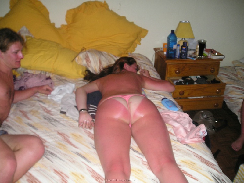 Девка уснула на пляже и ее кожа стала красной 12 фото